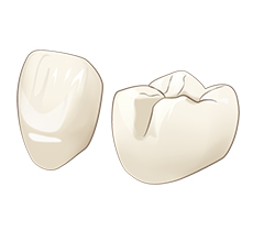 セラミック治療なら｜寝屋川市の歯医者｜萱島駅前歯科